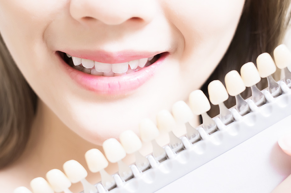 美しいお口元をめざす ホワイトニング